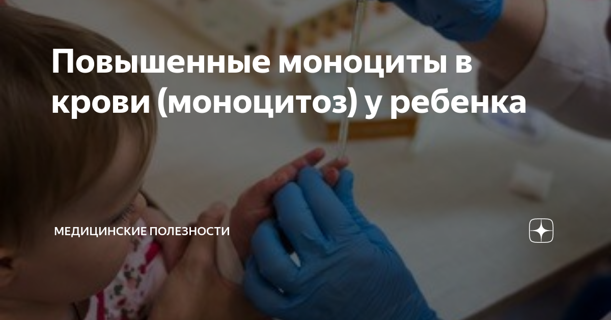 Моноциты повышены у ребенка. Причины: от насморка до лейкоза - дачник-4.рф