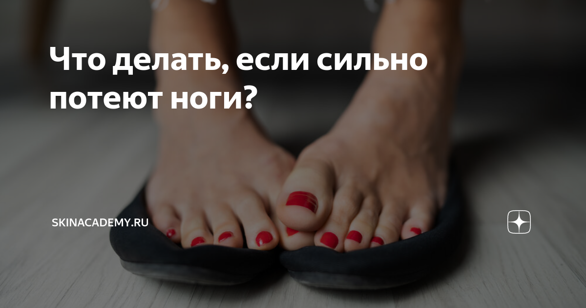 Потливость ног – причины, эффективные способы профилактики