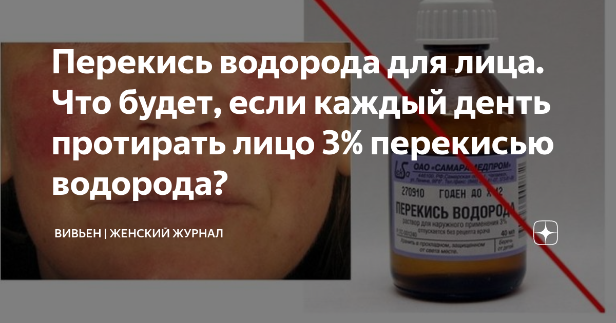 Перекись водорода протирать кожу. Примочки перекисью водорода. Что будет если протирать лицо перекисью водорода.