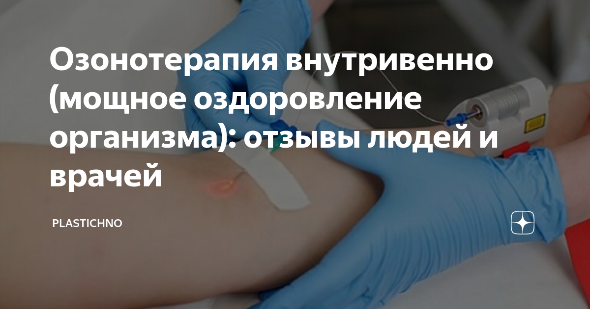 Озонотерапия отзывы пациентов Озонотерапия отзывы пациентов