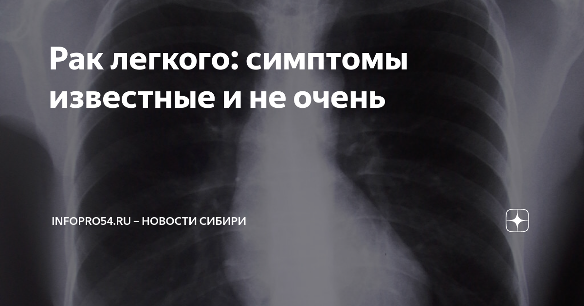Рак легкого: симптомы известные и не очень | Infopro54.ru – Новости ...