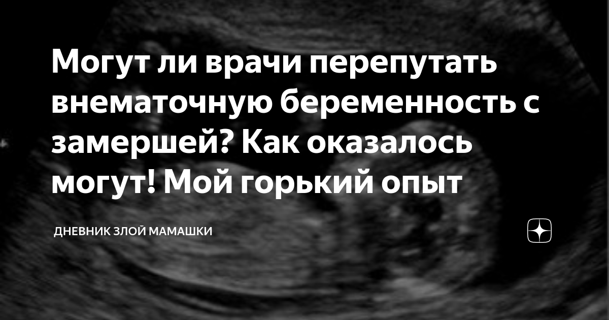 эктопическая беременность узи. неправильный диагноз врачей. узи почек хронический пиелонефрит заключение. пост о врачах. врач поставил диагноз.