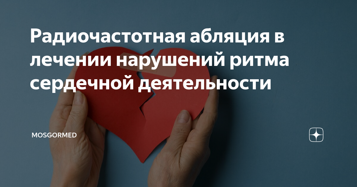 Радиочастотная абляция в лечении нарушений ритма сердечной деятельности ...
