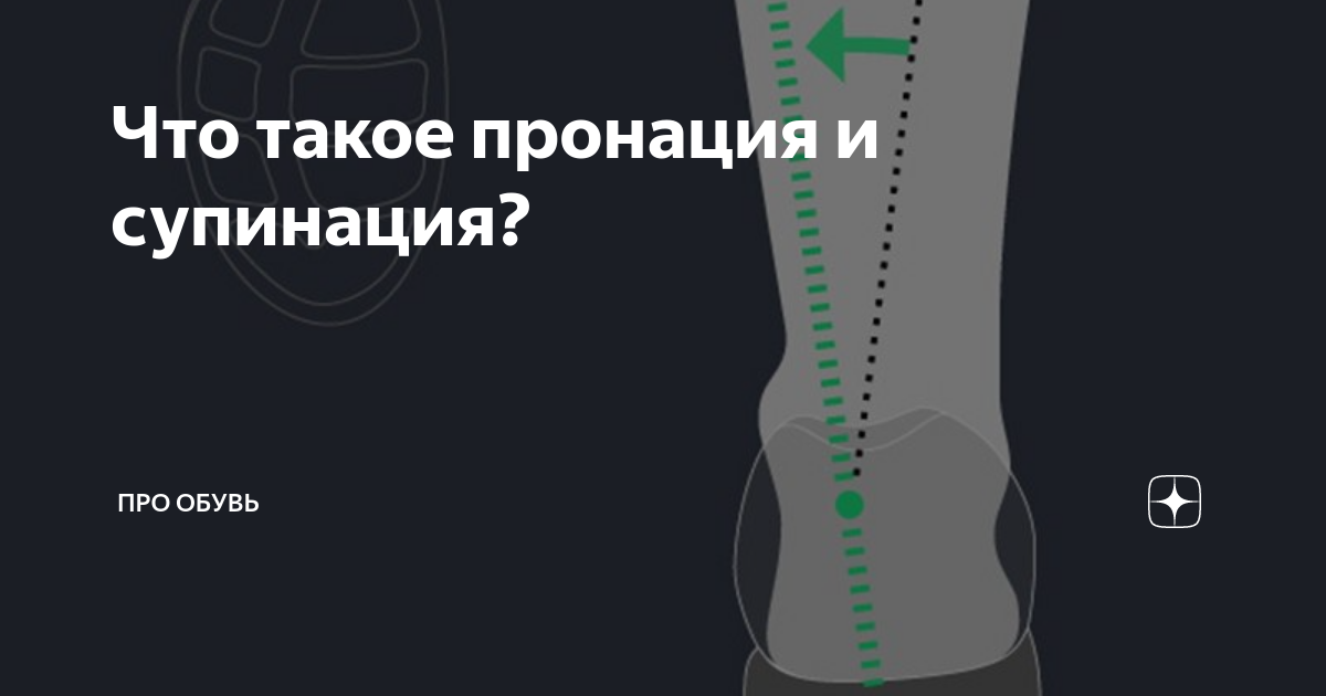 Что такое пронация и супинация? | Про Обувь | Дзен