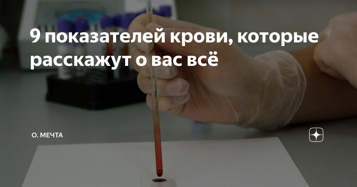 Поворот судьбы кровь не водица. Девять показателей крови, которые расскажут о вас всё. Анализ крови из пальца 5 июня 2017 Настя понедельник.