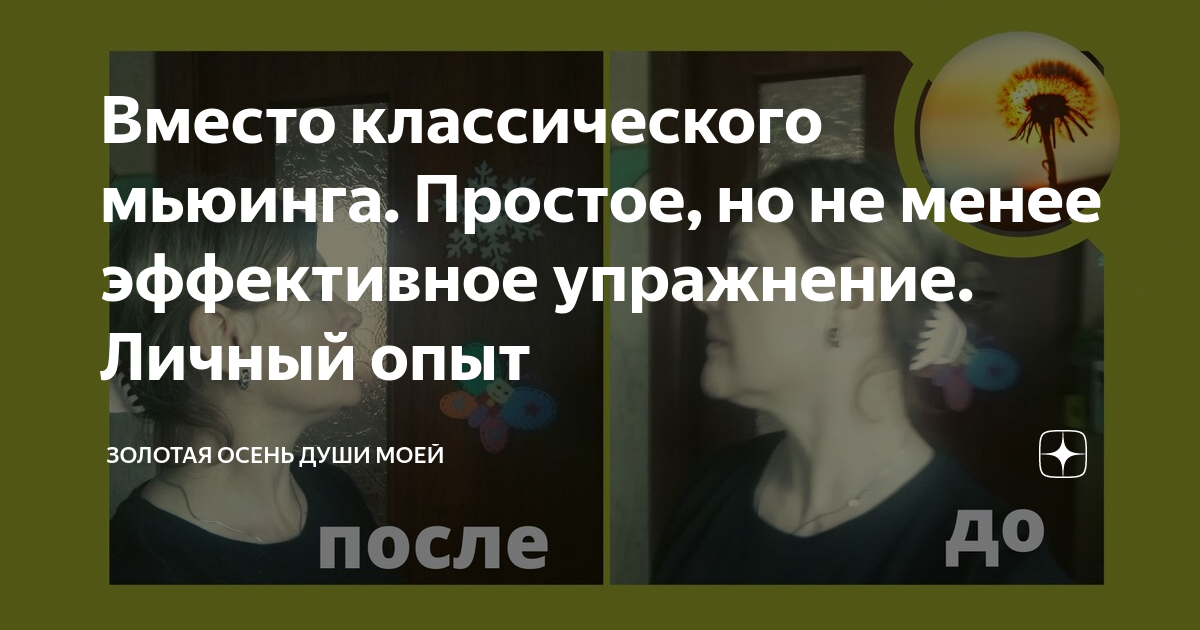 Музыка мьюинга. Упражнения мьюинга лица. мьюинг доктор мью. мьюинг положения языка. максилла мьюинг.