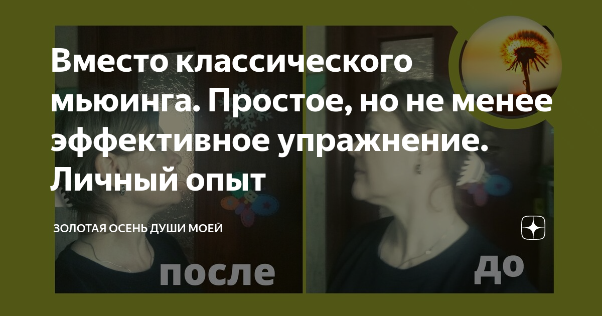 Мьюинг как правильно держать. Мьюинг. Упражнения Мьюинга лица. Мьюинг доктор Мью. Мьюинг положения языка.