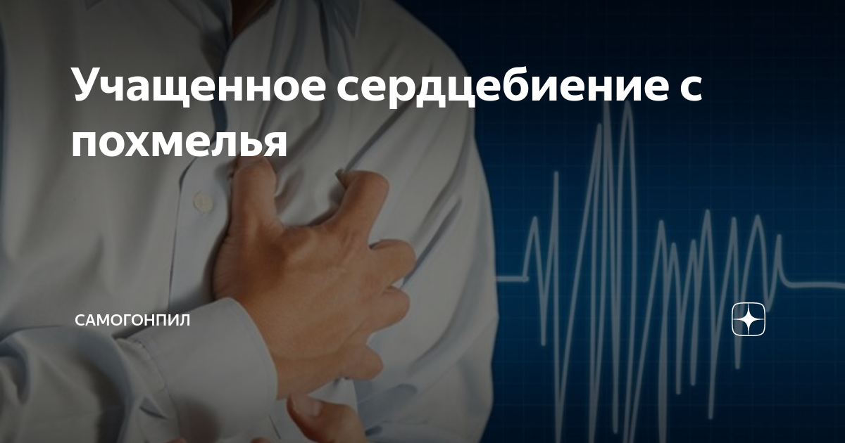 Почему с похмелья быстро бьется сердце? Диагностика и помощь