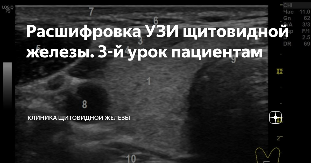 Узи щитовидной железы в екатеринбурге. Ультразвуковое исследование (УЗИ) щитовидной железы. УЗИ щитовидной железы на УЗИ. Пищевод на УЗИ щитовидной железы