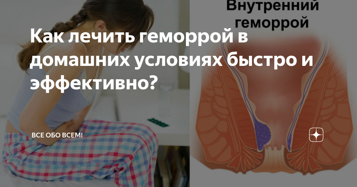 Лучшее лечение геморроя в домашних условиях: эффективные методы и рекомендации Т