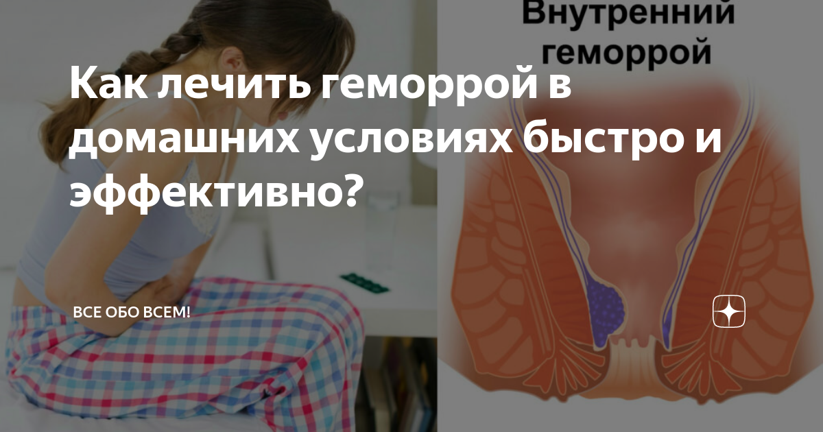 Лечение геморроя в домашних условиях: симптомы, советы и средства