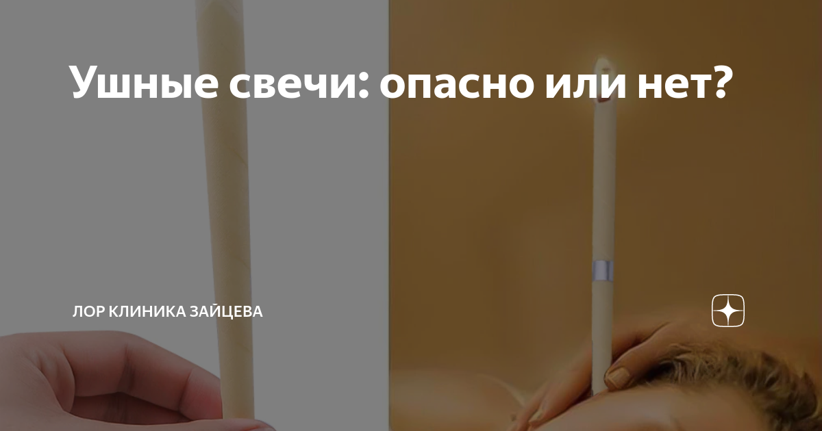 Как ставить ушную свечу. Как ставить ушную свечу