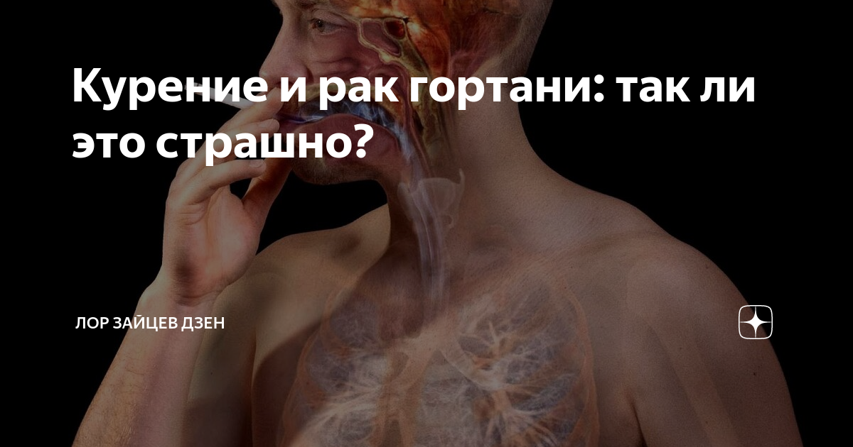 Курение и рак гортани: так ли это страшно? | ЛОР КЛИНИКА ЗАЙЦЕВА | Дзен