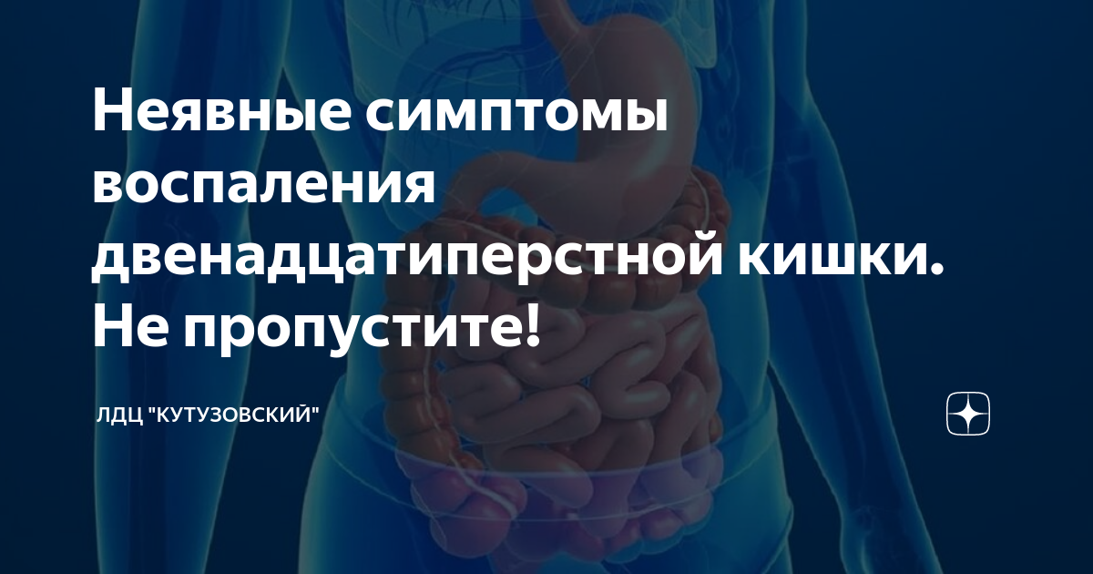 Симптомы воспаления тазобедренного сустава. Стул после операции на тазобедренном - 97 фото Коксартроз тазобедренного сустава ️: симптомы, причины, диагностика и. Дисплазия тазобедренного сустава у взрослых: симптомы, диагностика.