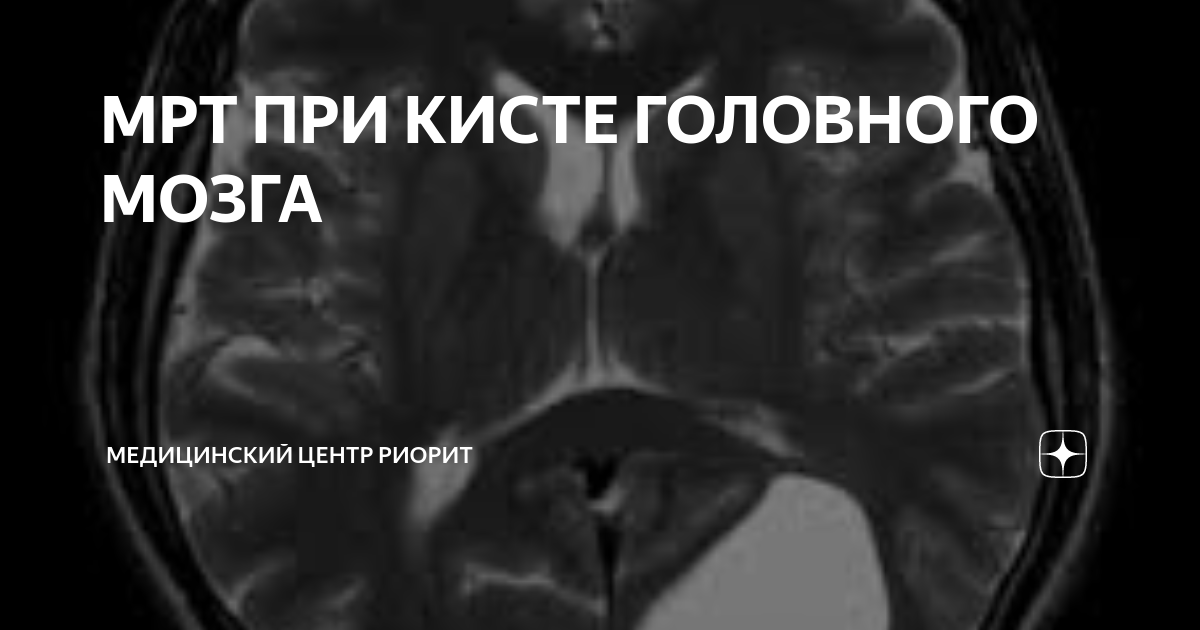 Клиника риорит мрт. Медцентр риорит руставели 66. Клиника риорит спб. Мрт ул руставели 66 спб. Риорит мрт центр.