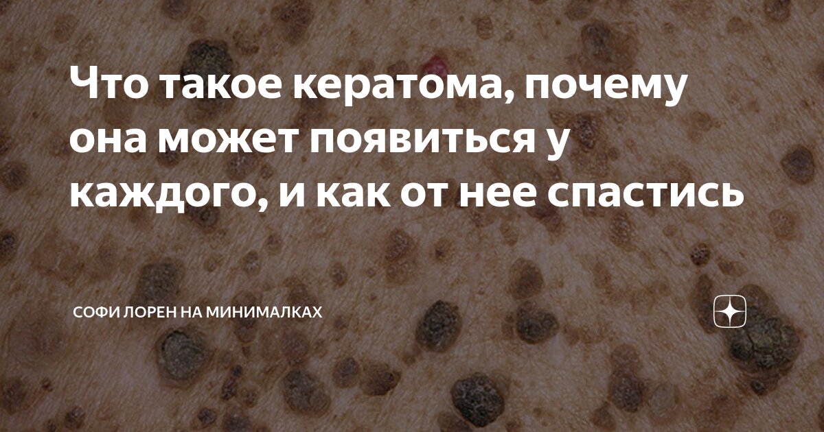 Кератома это что фото такое простыми