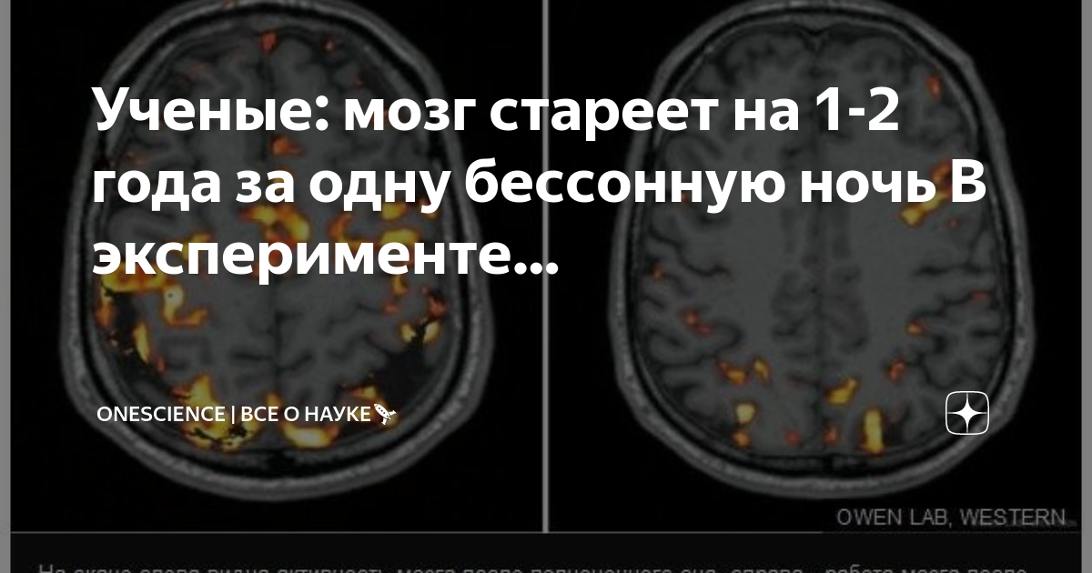 Ученые о мозге человека. Нестареющий мозг. Мозг стареет. Исследование мозг стареет. Мозг Житеий.