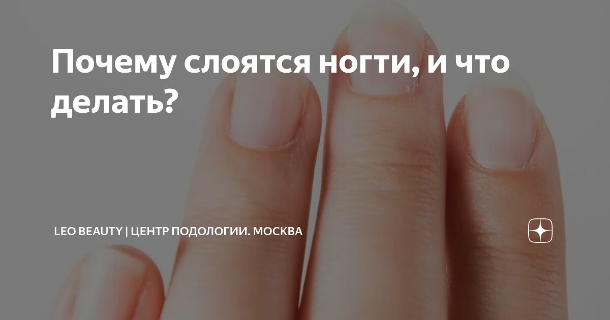 Почему не держится гель-лак? Как избежать отслоек | NailMania