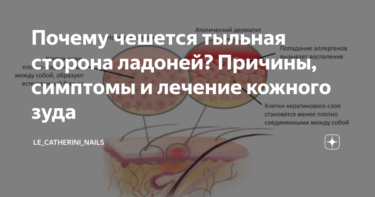 Примета если чешется губа. К чему чешется правая ладонь. К чему чешется левый локоть. К чему чешется правая ладошка. Примета чешется между пальцами левой руки.