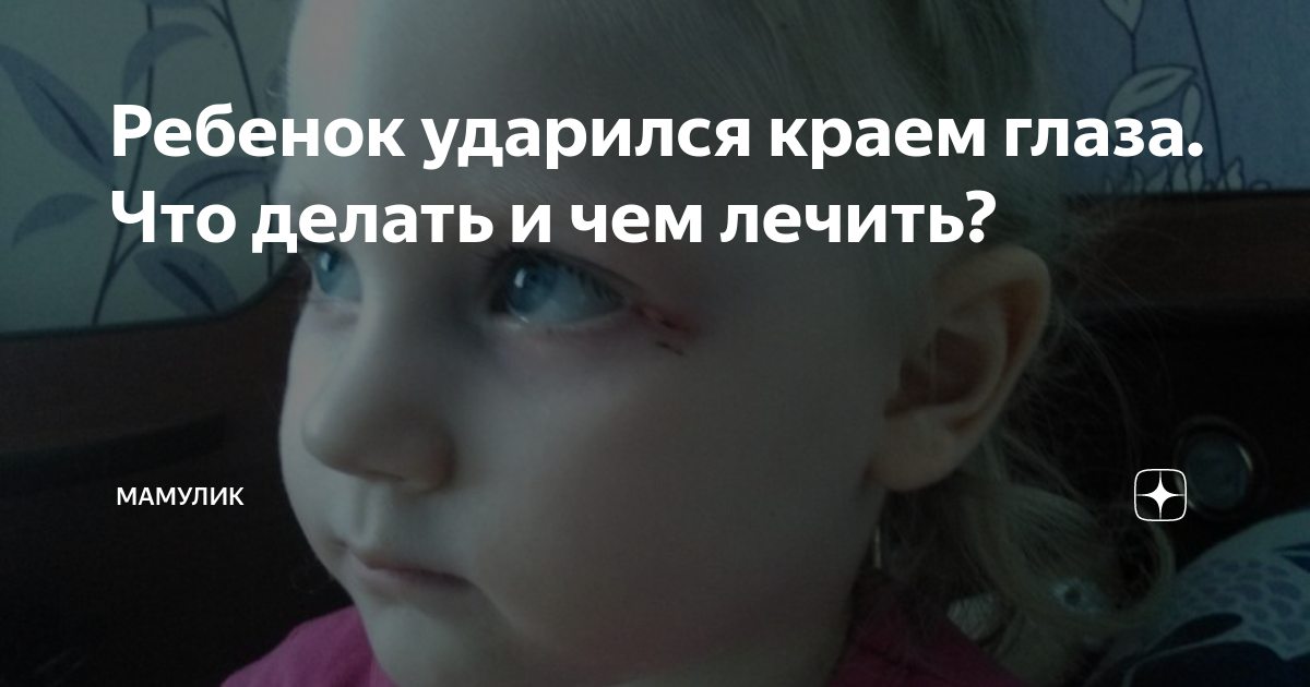 Ребенок упал носом об пол. Ребенок стукнулся головой что делать. Малыш ударился затылком. Ребенок упал и ударился затылком что делать. Ребенок упал ударился глазом что делать.