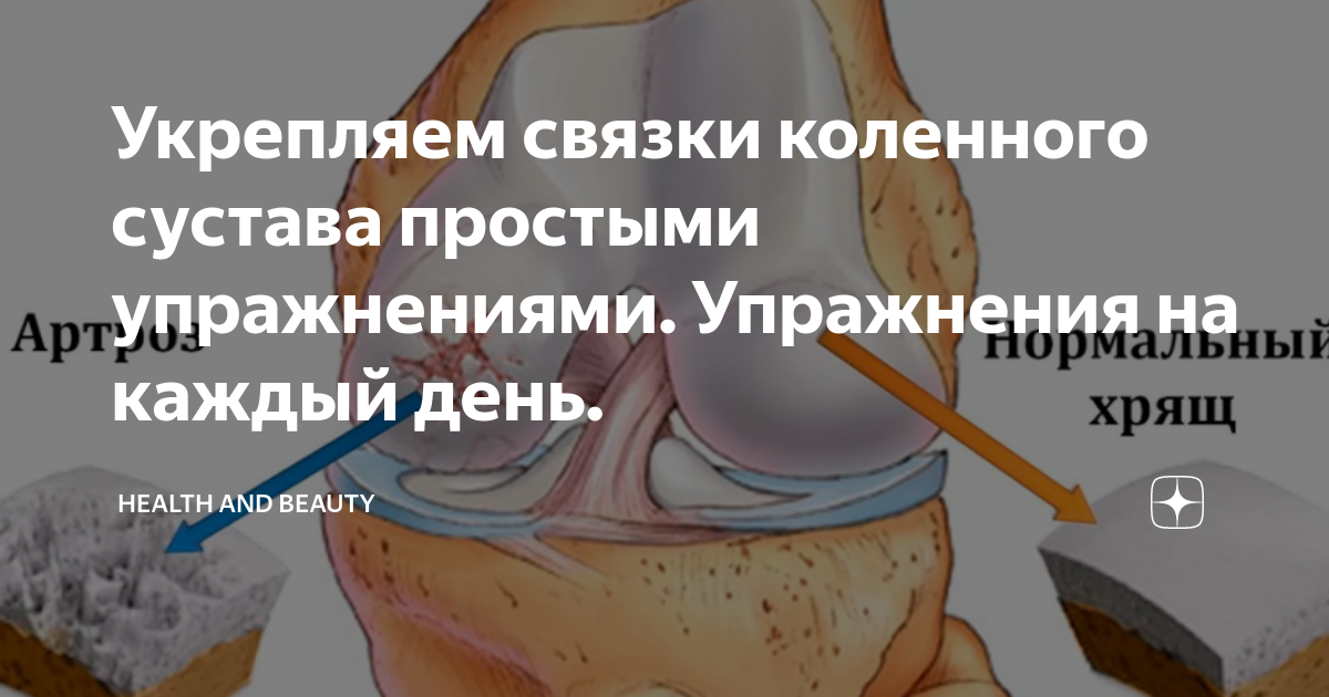 Операция связки коленного сустава отзывы. Укрепить коленные связки. Укрепляем связки колена. Укрепить связки коленного сустава.