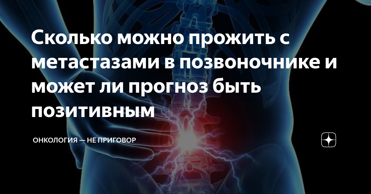 Рак проживи. Онкологические болезни позвоночника. Признаки онкологии позвоночника. Метастазы в спинном мозге Продолжительность жизни. Сколько живут с метастазами в позвоночнике.