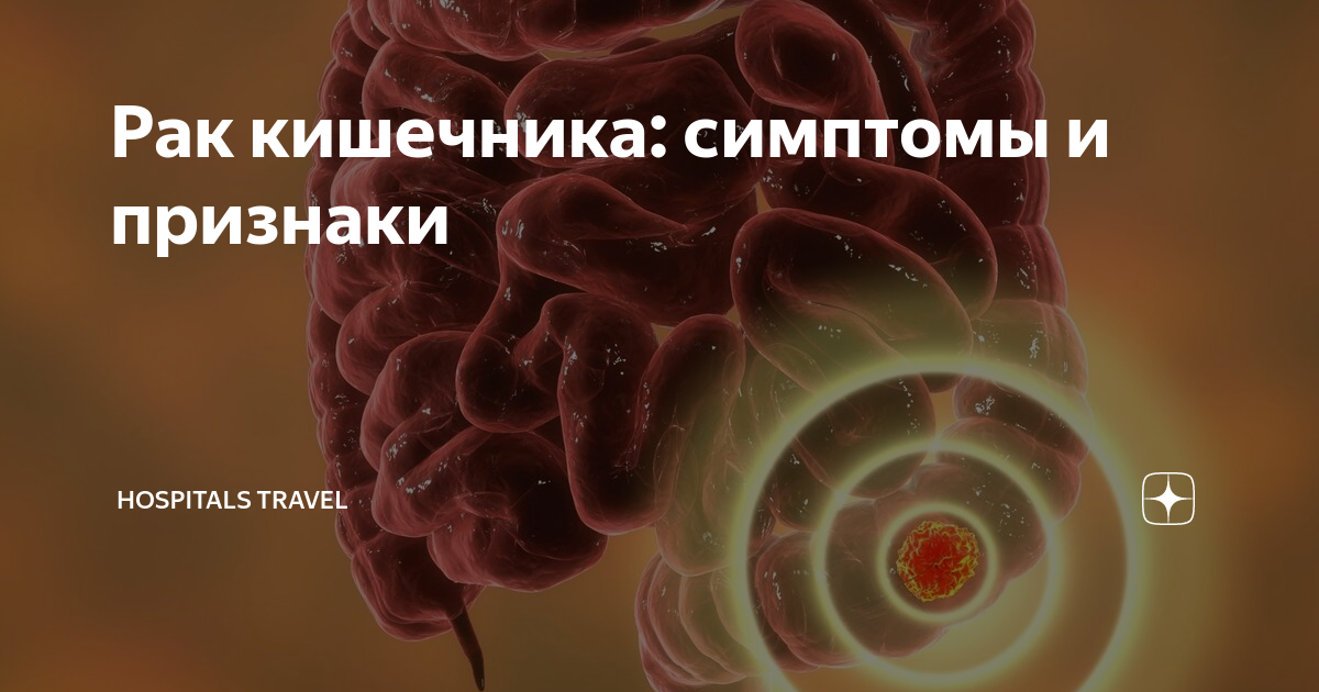 Рак кишечника: симптомы и признаки | Hospitals Travel | Дзен
