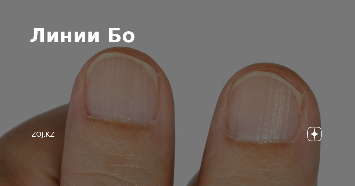 Заболевания ногтей и кожи для мастера ногтевого сервиса (с фото)