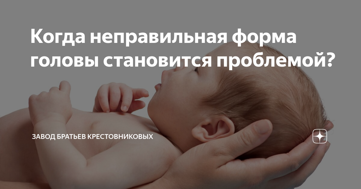 Деформация головы у новорожденного - что нужно знать родителям - dobroheart.ru