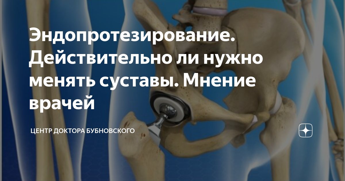 Восстановление суставов операция. Реабилитация после эндопротезирования эндопротезирования коленного. Упражнения после эндопротезирования коленного сустава. Эндопротезирование тазобедренного сустава рекомендации.