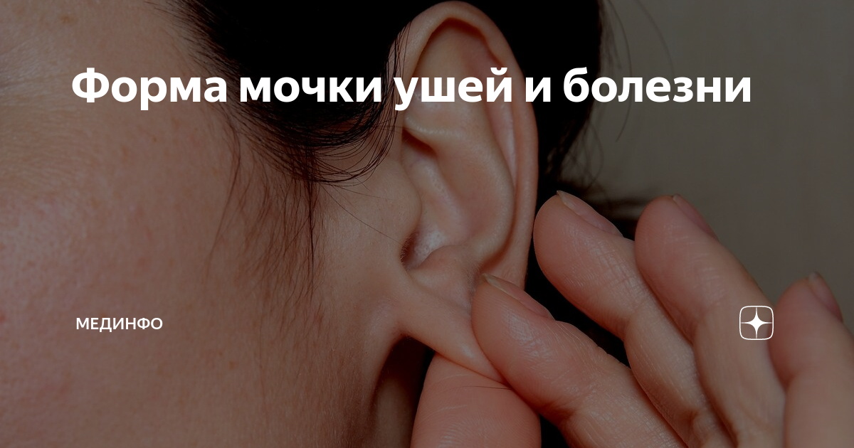 Форма мочки ушей и болезни | МедИнфо | Дзен