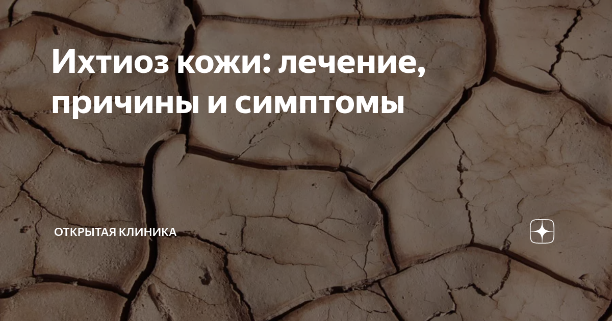 Ихтиоз кожи: лечение, причины и симптомы | Открытая Клиника | Дзен