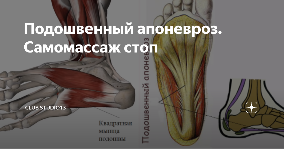 Подошвенный апоневроз. Подошвенный апоневроз стопы. Энтезопатия подошвенного апоневроза. Подошвенный апоневроз анатомия. Лигаментоз подошвенного апоневроза.