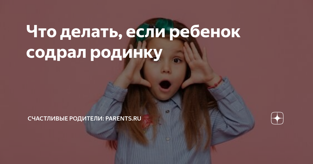 Что делать, если ребенок содрал родинку | Счастливые родители: Parents ...