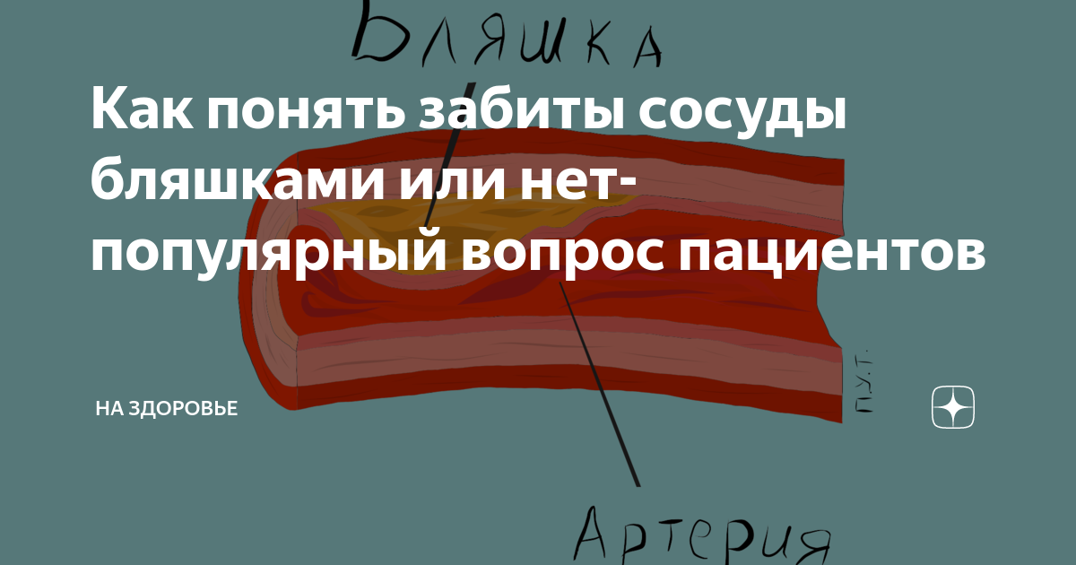 Как понять что забиты сосуды. От чего забиваются сосуды. Как понять что забитые сосуды. Как быстро забиваются сосуды.