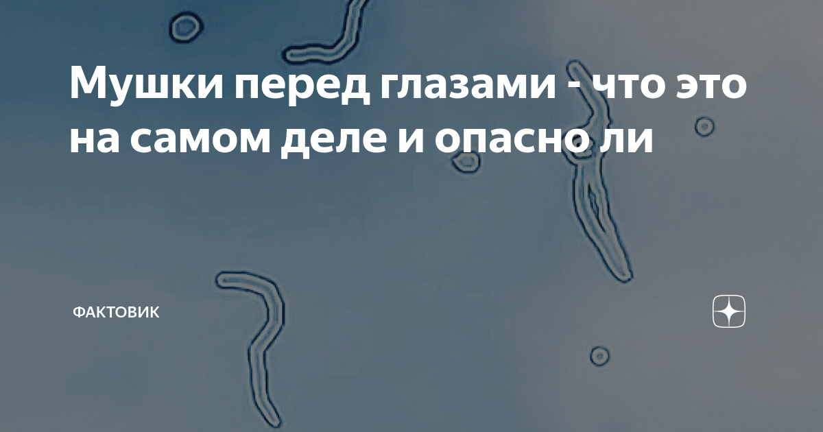 Мелькание мушек перед глазами. Чёрные мушки перед глазами. Летающие мушки перед глазами. Плавающие мушки перед глазами.