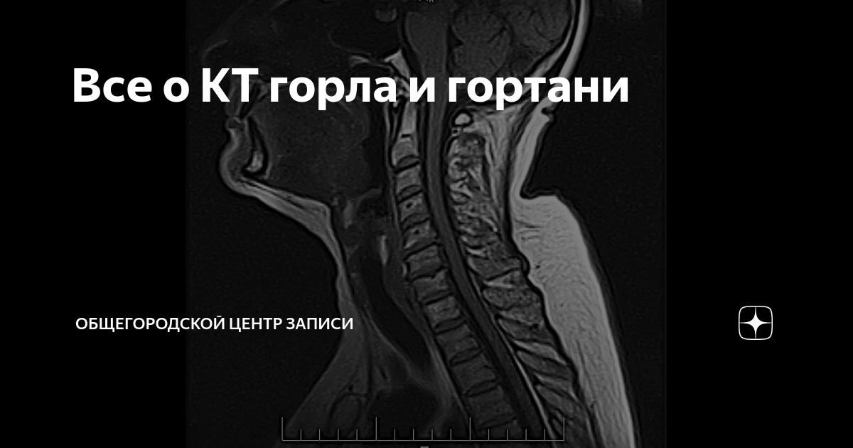 кт гортани москва