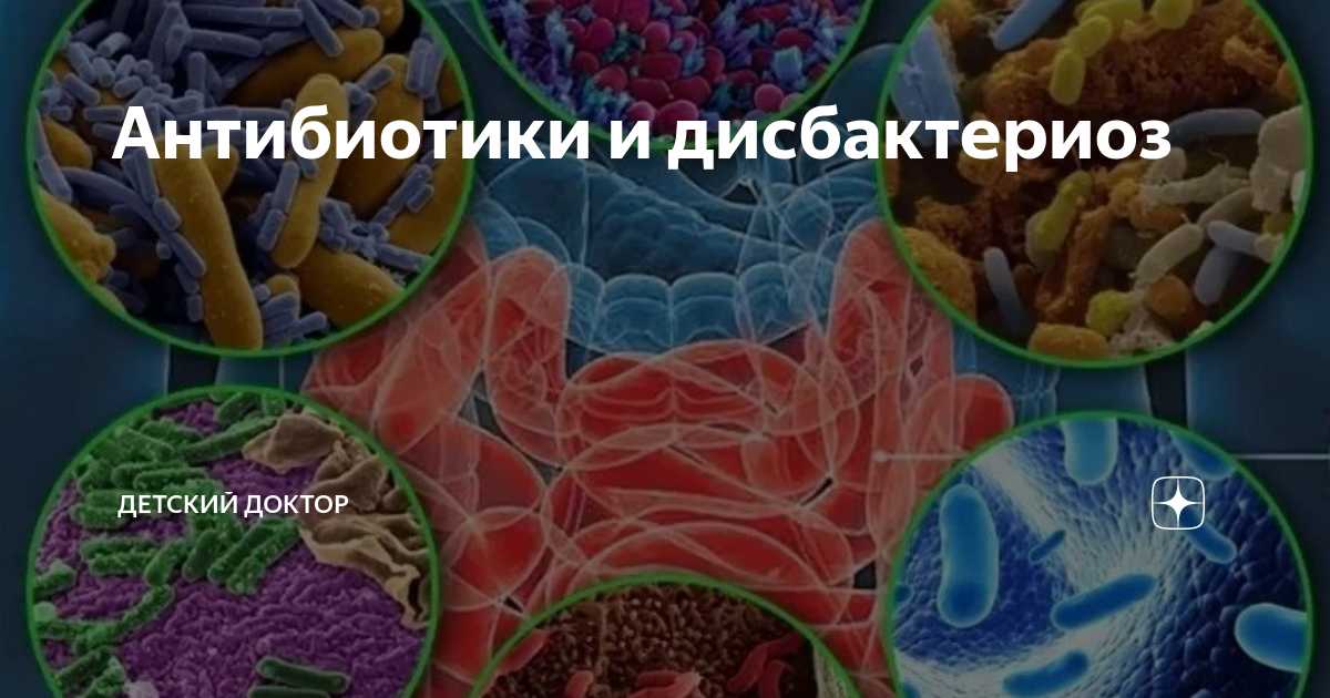 Дисбактериоз антибиотики. Дисбактериоз от антибиотиков. Бактерии при дисбактериозе. Дисбактериоз картинки.