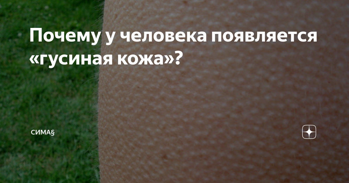 Фолликулярный гепотоз. Почему у людей гусиная кожа. Фолликулярный гепотоз. Гусиная кожа фолликулярный. Фолликулярный кератоз («гусиная.
