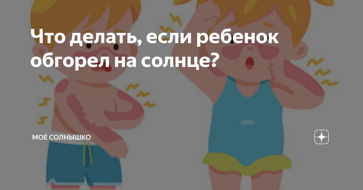 Что делать, если ребенок обгорел на солнце и чем помазать ожоги у малыша