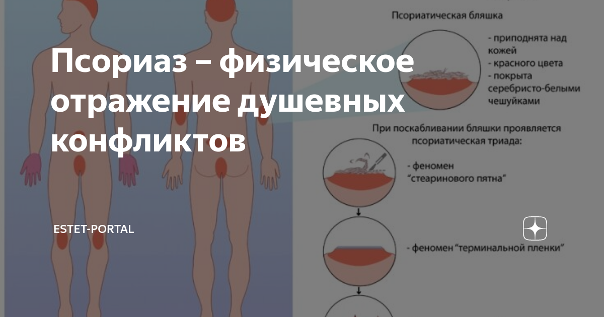 провоцирующие факторы псориаза. псориаз психосоматика причины заболеваний. псориаз психосоматика луиза хей. понятие психосоматика. психосоматика таблица заболеваний щитовидной железы.