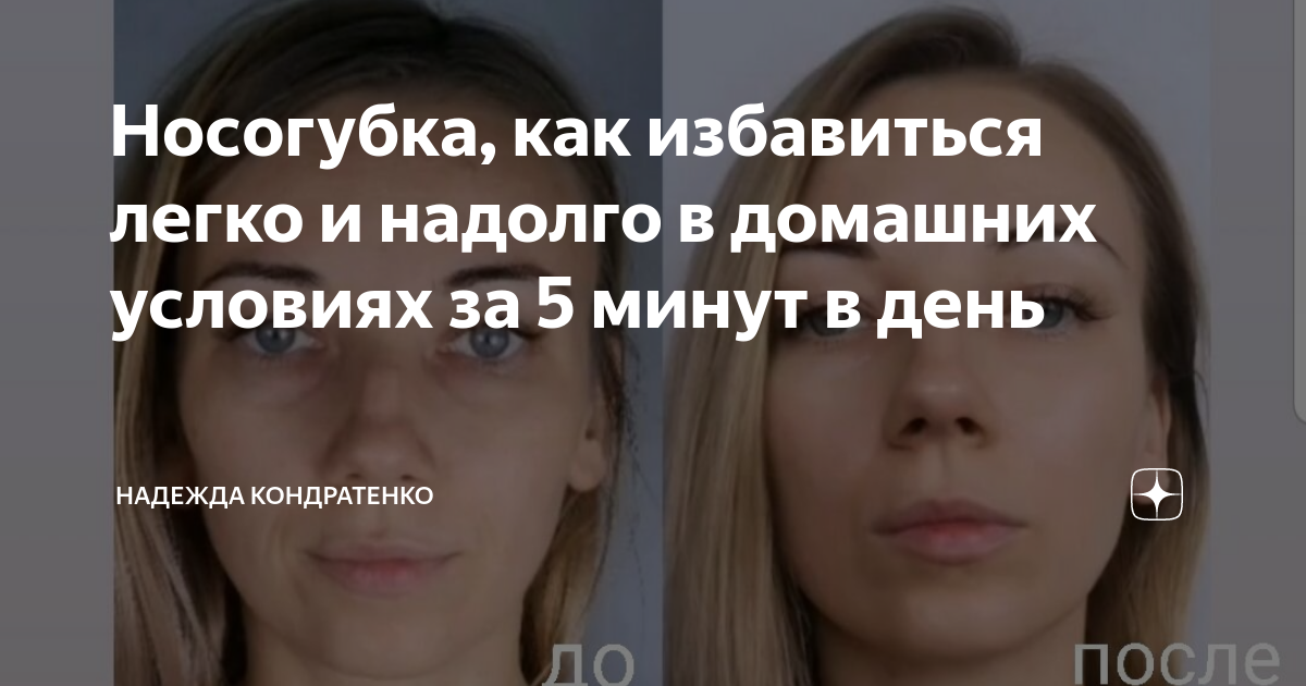 Носогубка, как избавиться легко и надолго в домашних условиях за 5 ...