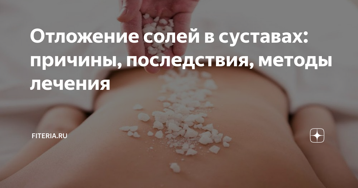 Хондрокальциноз - отложение солей кальция в позвоночнике и суставах.