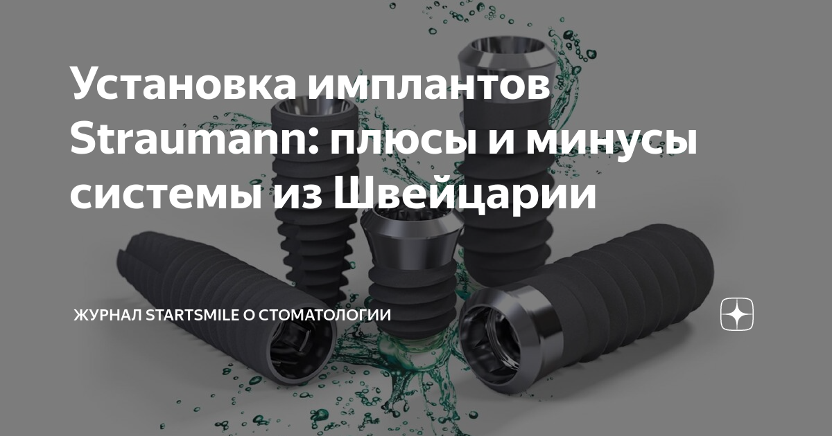 Установка имплантов Straumann: плюсы и минусы системы из Швейцарии ...