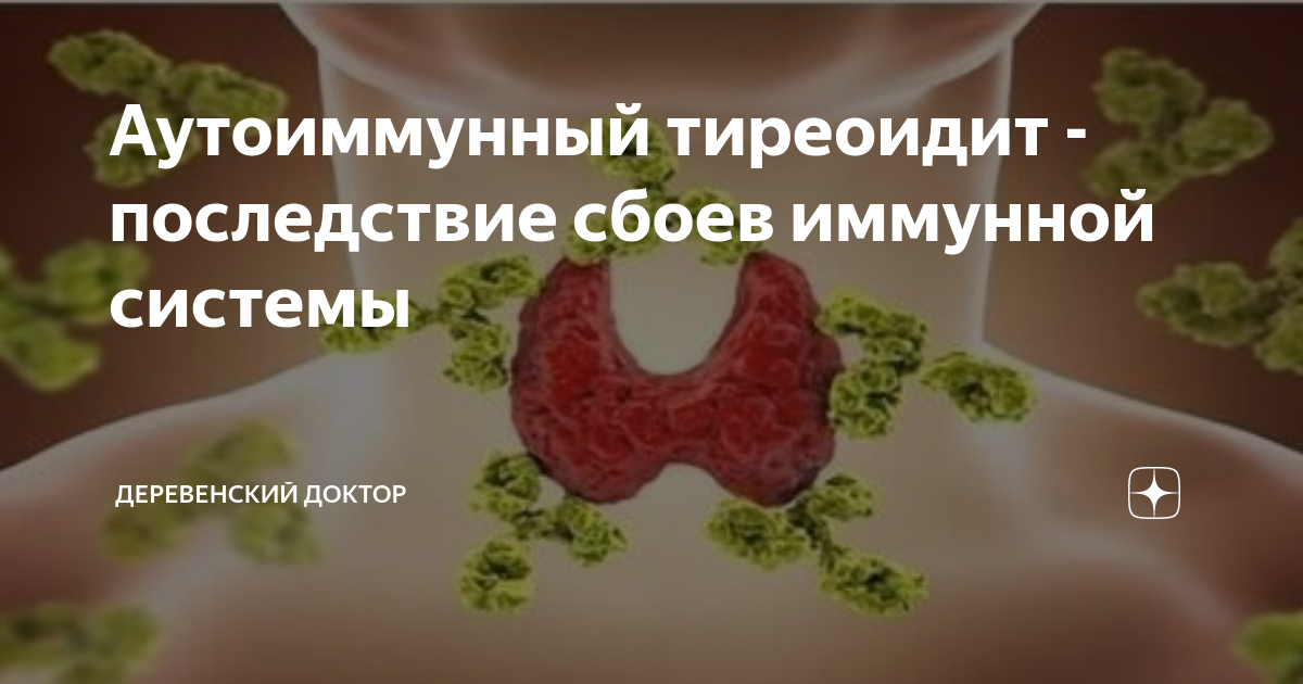Аутоиммунный тиреоидит - последствие сбоев иммунной системы ...