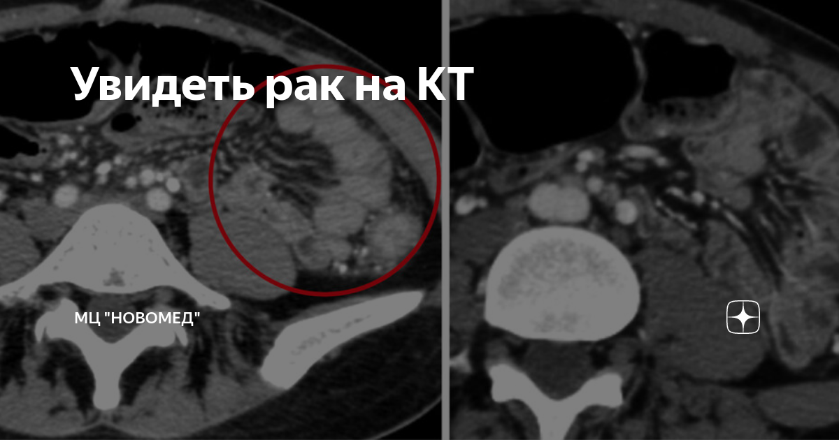 рачки домашние животные. мир глазами богомола. как видит креветка богомол. увидеть рака. креветка богомол зрение.