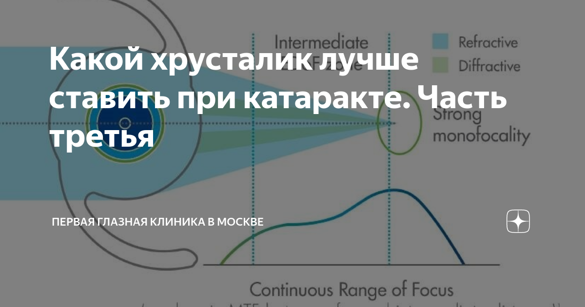 Какой хрусталик лучше ставить при катаракте. Часть третья | Первая ...