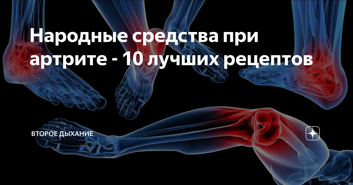 Народные средства при артрите - 10 лучших рецептов | Второе дыхание | Дзен
