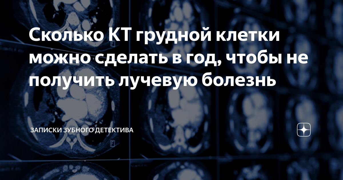 Через сколько делают повторно кт. Вредно ли кт в этом году сделала 2 раза кт после Ковида и. Сколько раз нужно сделать рентген чтобы получить лучевую болезнь. 50 Мм кт сколько тело ребенка. 550 Кт это сколько.