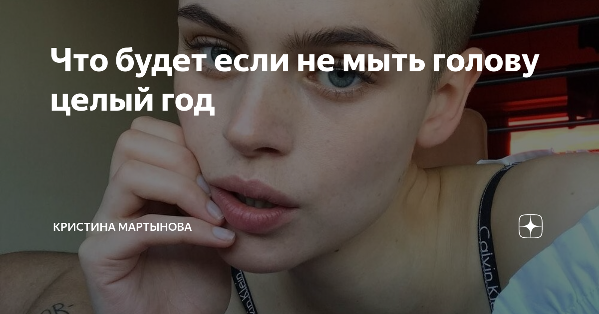 чешется голова на третий день после мытья